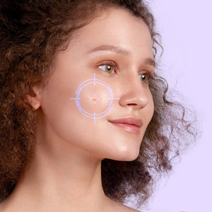 FOREO ESPADA Blue Light Acne Treatment Device