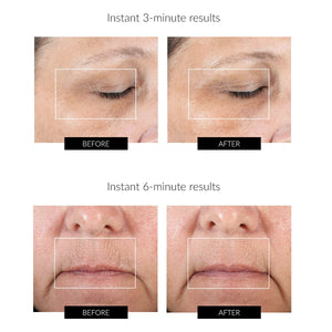 NuFACE Complete Microcurrent Kit for Face and Eyes (worth £325)