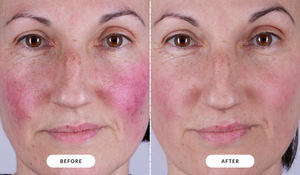 CurrentBody Skin LED Eye Perfector