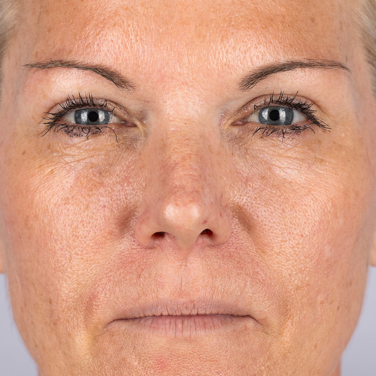 Radio Frequency Skin Tightening Device | CurrentBody Skin