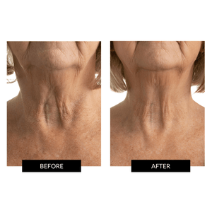 Currentbody Skin Neck and Dec & Neck and Dec Hydrogels x5