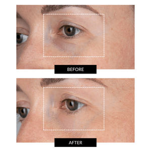 CurrentBody Skin LED Eye Perfector & Green Tea Serum (30ml)