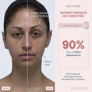 NuFACE Mini+ Facial Toning Starter Kit