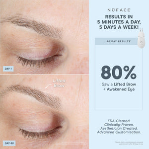 NuFACE TRINITY+ Smart Facial Toner and Effective Lip & Eye Attachment