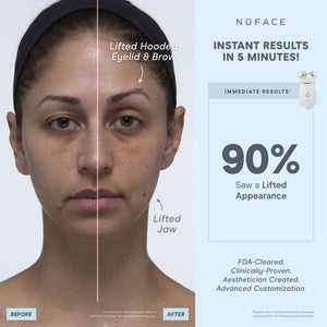 NuFACE TRINITY+ Starter Kit Smart Facial Toning Device
