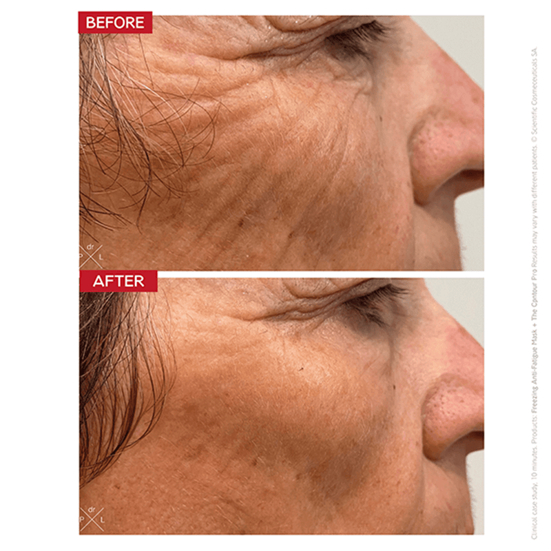 Dr. Levy The Contour Pro CurrentBody