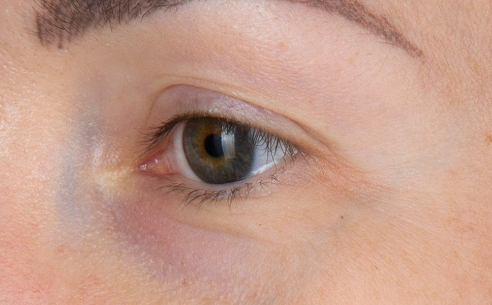 LED Eye Perfector Red Light Therapy Eye Mask CurrentBody Skin