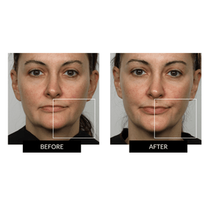 NuFACE TRINITY+ Supercharged Skincare Routine