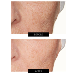 Lancer Skincare Overnight Brightening Mask (30ml)