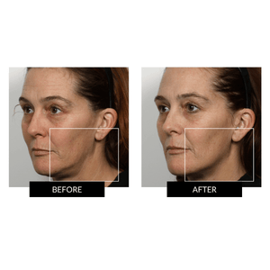 NuFACE Mini+ Supercharged Skincare Routine
