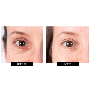 CurrentBody Skin LED Eye Perfector & 5 Eye Hydrogel Masks (worth £224)