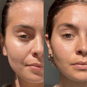 FOREO BEAR Facial Toning Device